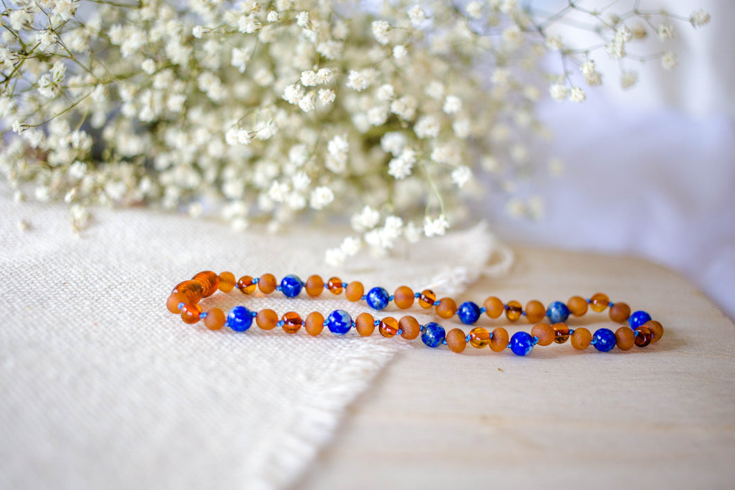 Adult Necklace | Baltic Amber | shopnesting